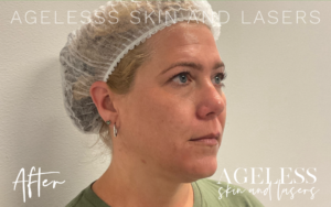 After Image: 3D Miracl Pigment Results