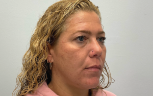 Before Image: 3D Miracl Pigment Results
