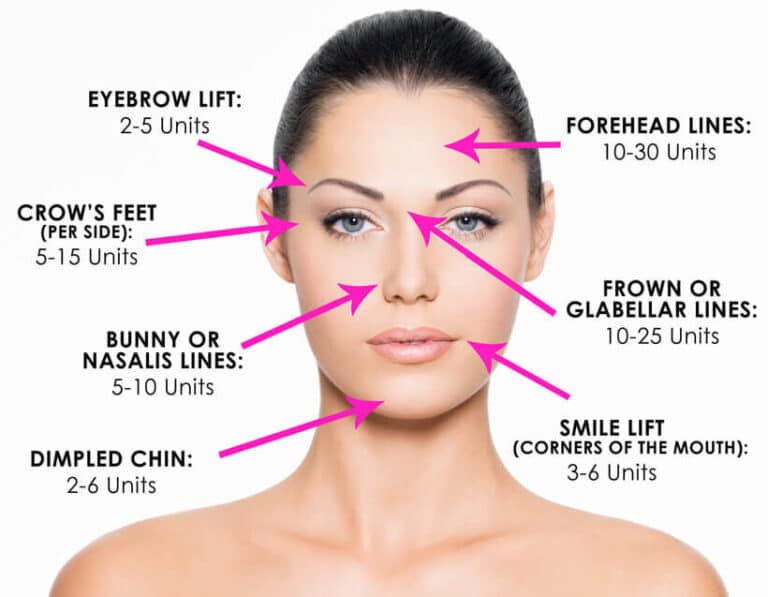 Botox-Injection-Sites-and-Amounts-e1590526623250-768x597-1 Botox Injection Sites and Amounts e1590526623250 768x597 1